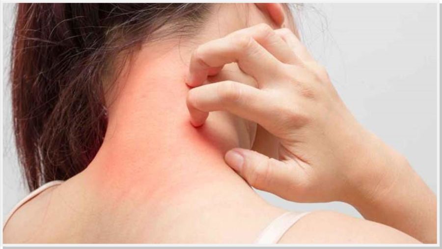 Alergias em foco: Dra Renata Grandi Loschi - Alergologista e Imunologista esclarece dúvidas no programa Radar da Garbosa FM